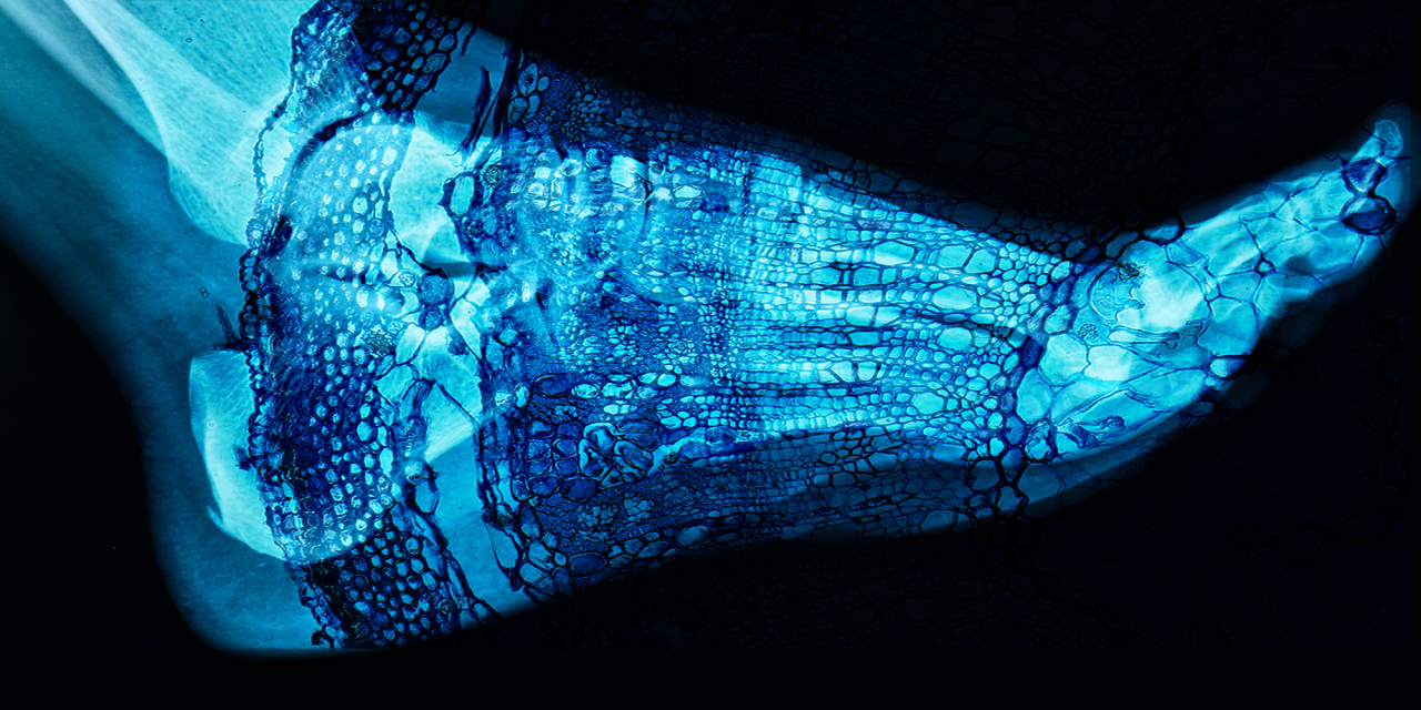 MEdical x-ray of a foot with a cell overlay in blue.
